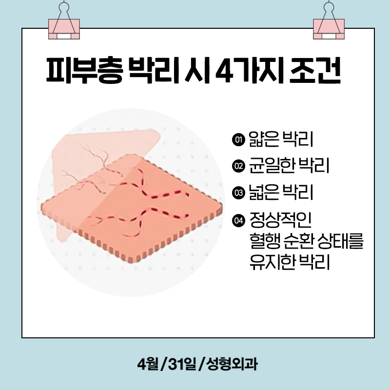 [Contracted Nose] Deep Analysis of the 5-Step Contracted Nose Correction Surgery Part 01_ Sufficient Dissection and Release image 5