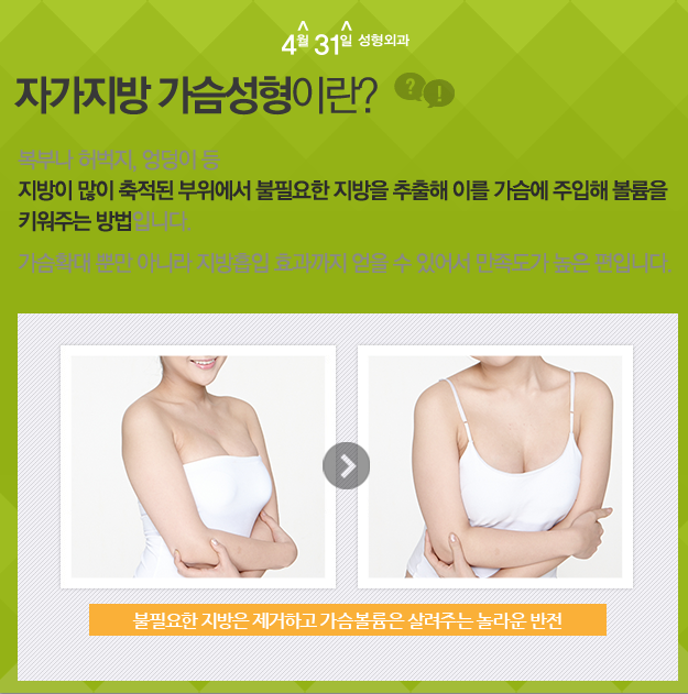 자가지방가슴수술 자연스러워요 관련 이미지 1