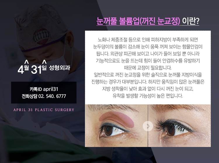눈지방재배치 알아보자 4월31일성형외과 관련 이미지 2