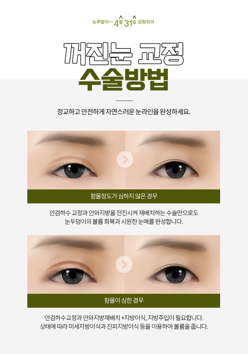 눈두덩이에서 고민되는 눈꺼짐을 개선하려면? 관련 이미지 6