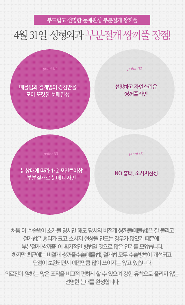 부분절개쌍꺼풀 4월31일성형외과에서 쉽게 관련 이미지 1