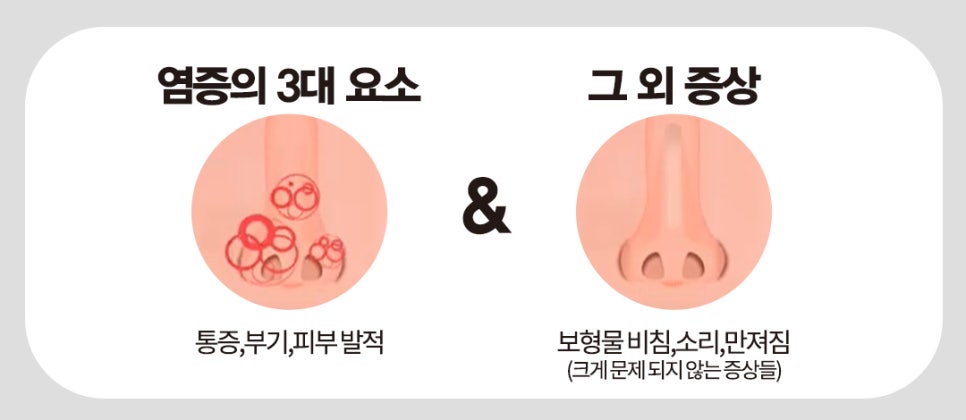 [코성형] 코수술 후 냄새나고, 딱딱 소리가 난다? 관련 이미지 2