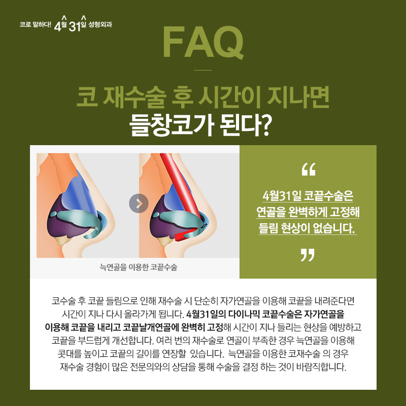 A Hospital in Gangnam That Does Nose Revision Surgery Well: Accurate, Yet Professional image 4