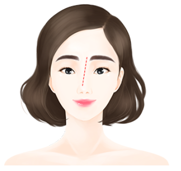 [코성형] 얼굴의 중심을 바로잡는 휜코 교정술 관련 이미지 3