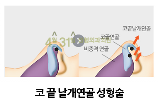 코길이축소 더 어려보이게 관련 이미지 4