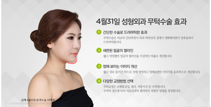 무턱수술비용 4월31일성형외과와 상담하세요 관련 이미지 1