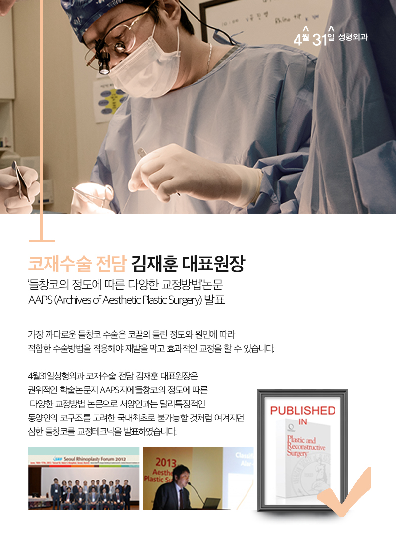 들창코수술비용 부담스럽지 않게 관련 이미지 5