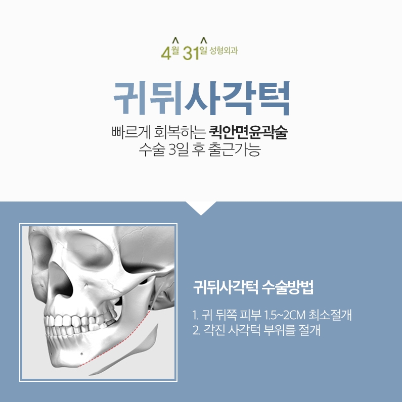 사각턱교정수술비용 제대로 알아보세요 관련 이미지 3