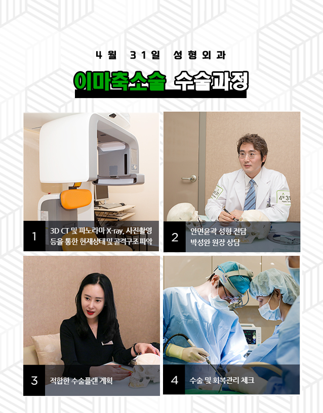이마축소술 흉터걱정없는 4월31일성형외과 관련 이미지 4