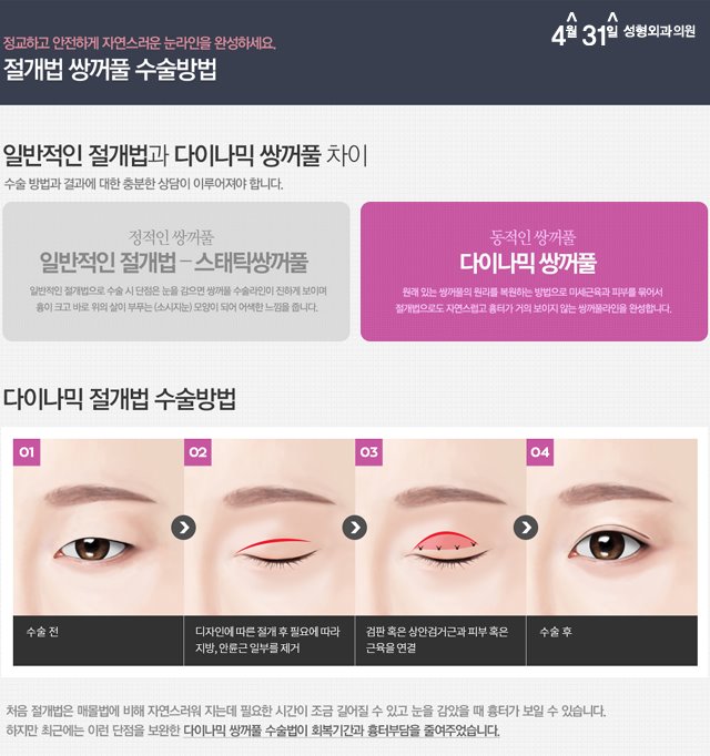 눈쌍커풀수술 흉터 적은 4월31일성형외과의원 관련 이미지 2