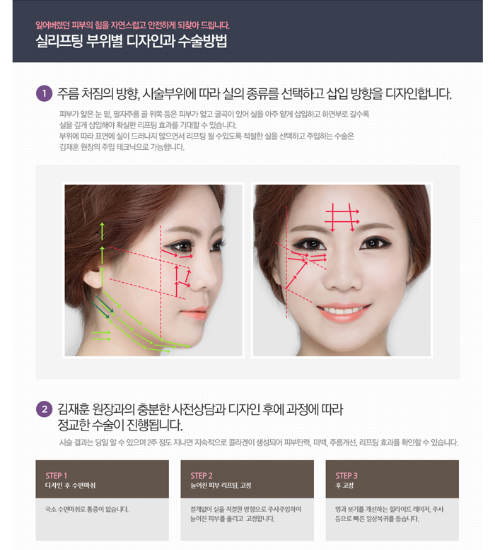 리프팅병원 4월31일성형외과의 88리프팅 관련 이미지 4