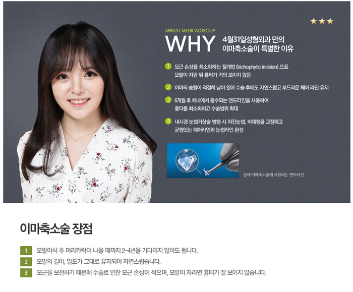 이마축소술 4월31일성형외과에서 흉터 걱정 없이 관련 이미지 2