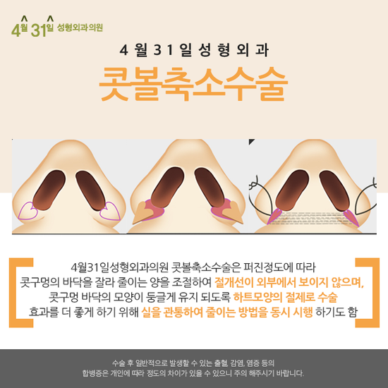콧볼수술 날렵한 코끝으로 세련되게! 관련 이미지 2