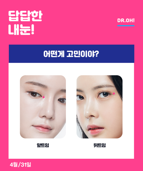 내게 꼭 맞는 눈트임수술 4월31성형외과 트윈클 트임 관련 이미지 2