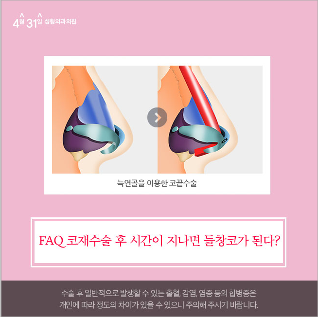 구축코재수술 해결은 4월31일성형외과에서 관련 이미지 3