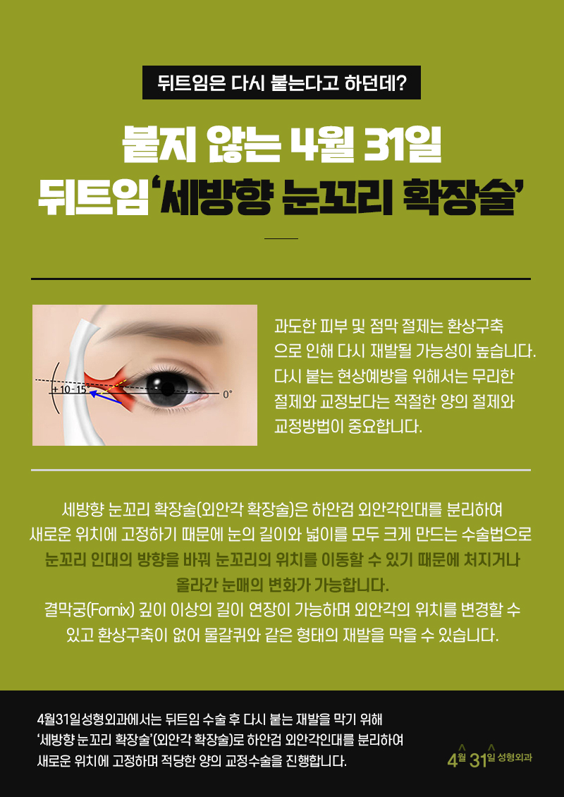 눈뒤트임수술 자연스럽게 4월31일성형외과 관련 이미지 3