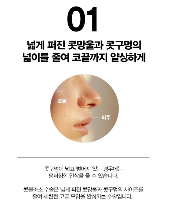 [코성형] 아름다운 코 모양의 완성은? 4/31 콧볼축소수술 관련 이미지 2