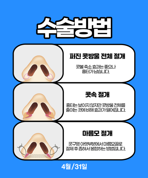 박성완원장의 콧볼축소술로 예쁜콧구멍 만들기! 관련 이미지 3
