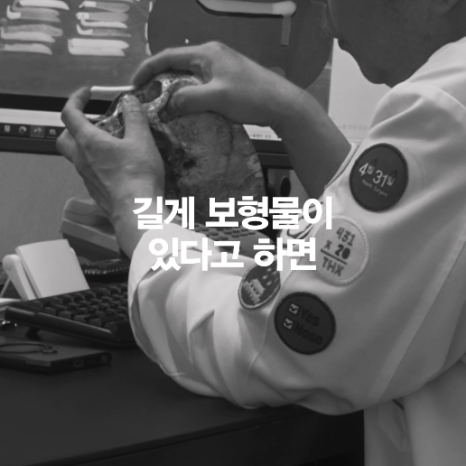 [April 31 Plastic Surgery] The silicone moved after nose surgery! Is that okay? image 7