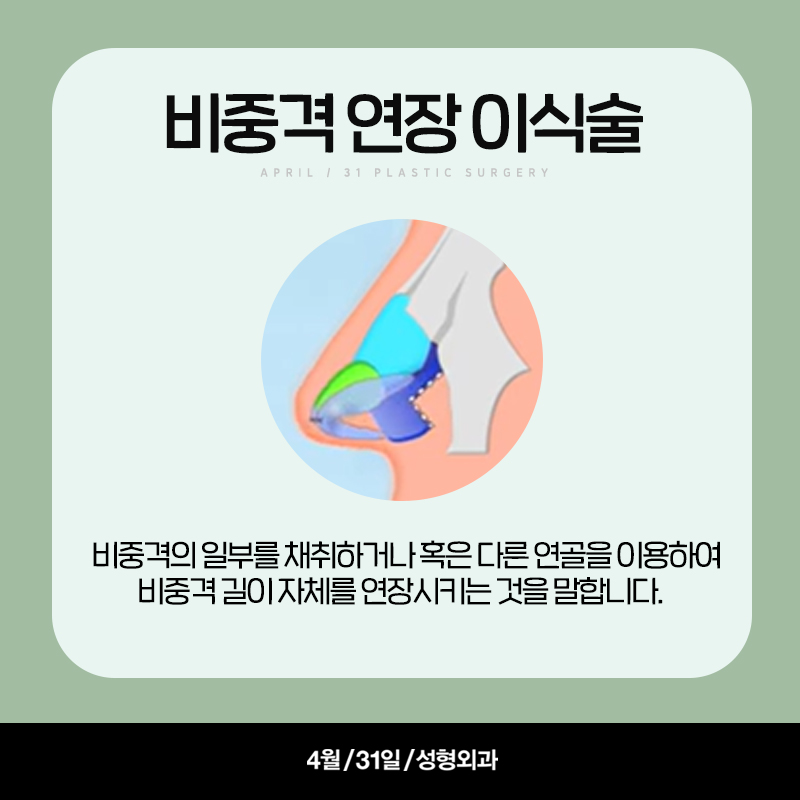 [구축코] 구축코 교정술 5단계 심층분석 Part03_이완시킨 연골 구조의 고정 관련 이미지 6