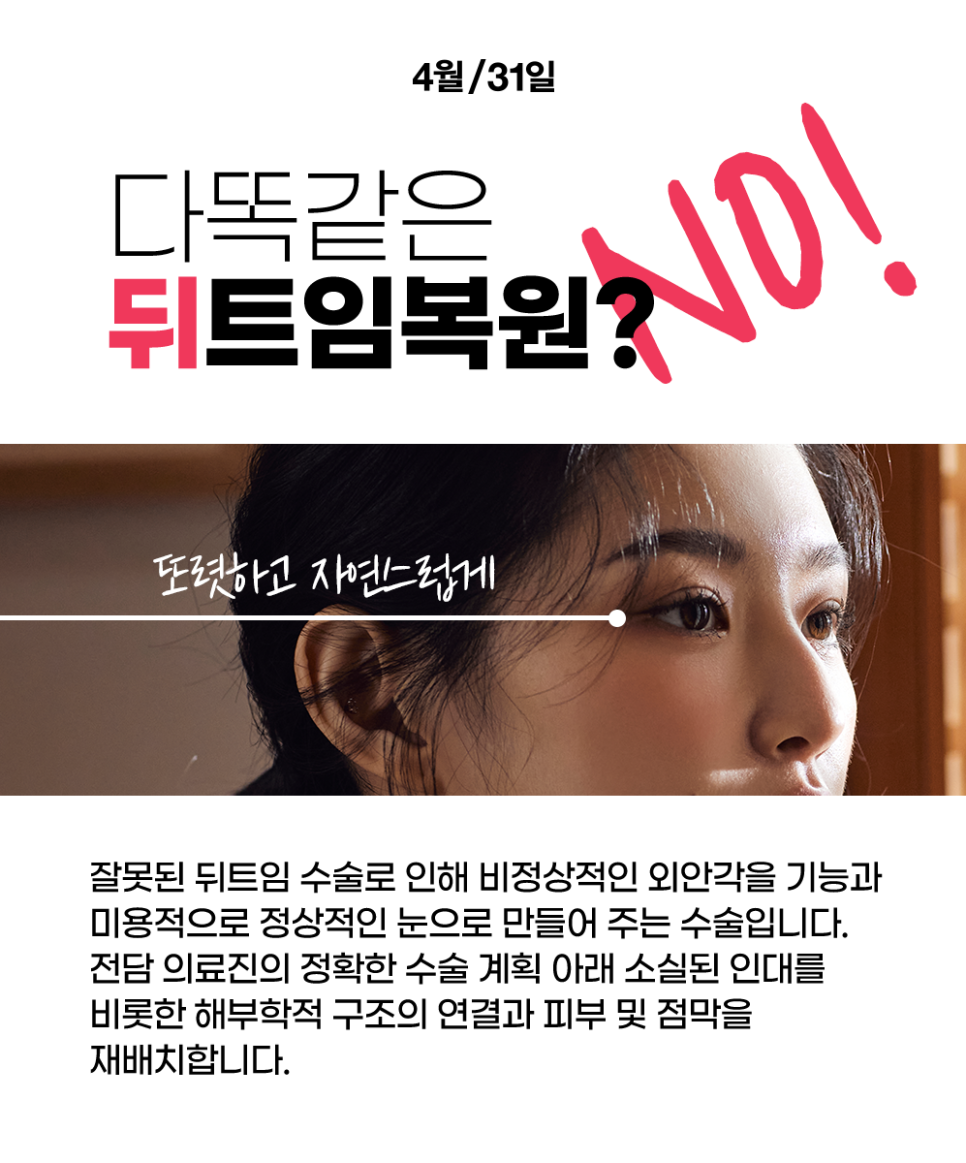 4월31일 Plastic Surgery Clinic: Wrong Epicanthoplasty or Canthoplasty? The Solution Is Right Here! image 3