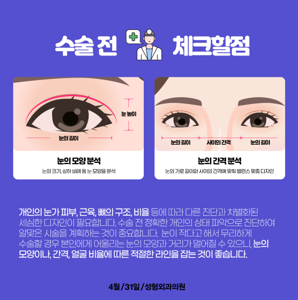 4월31일이 쌍꺼풀수술유명한병원으로 소문난 이유!? 관련 이미지 2