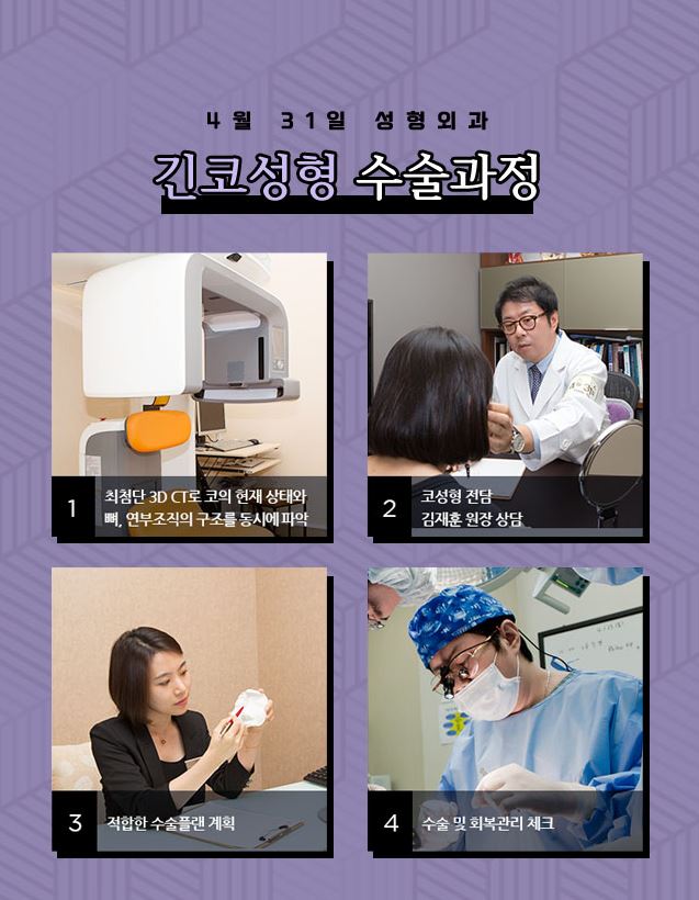 코성형잘하는곳 4월31일성형외과의원 긴코성형 알아봐요 관련 이미지 5