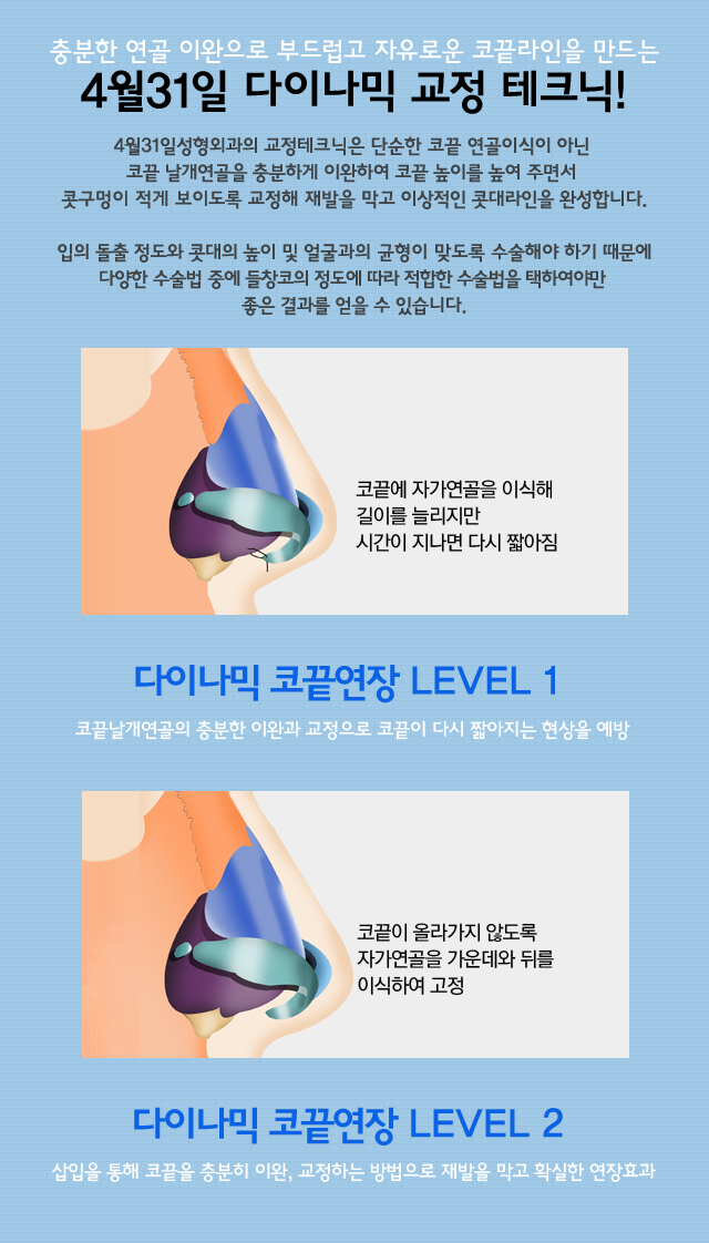 들창코성형후기 믿음 가는 4월31일성형외과의원 관련 이미지 2