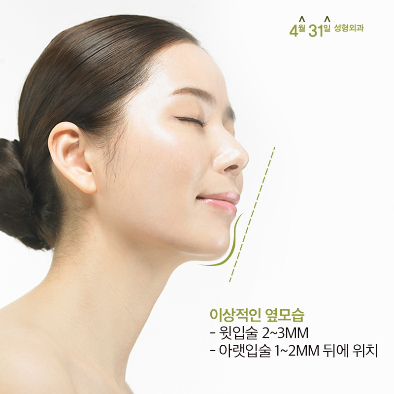 무턱수술잘하는곳 4월31일성형외과의 포인트! 관련 이미지 2