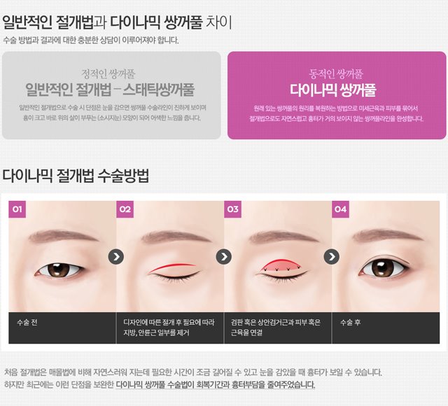 눈성형수술잘하는곳 절개법은 4월31일성형외과의원 관련 이미지 2