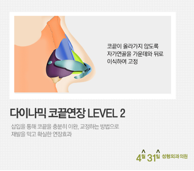 들창코성형 재발 줄이는 4월31일성형외과의원 관련 이미지 3