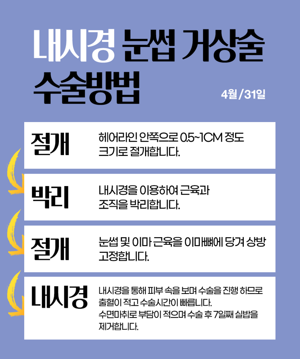 내시경눈썹거상술 처진 눈썹과 눈매를 시원하게! 관련 이미지 4