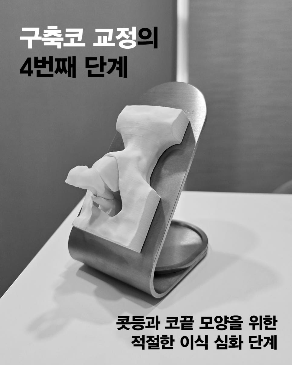 [Contracted Nose] Deep Analysis of the 5th Stage of Contracted Nose Correction / Part_04 Appropriate Grafting for the Nasal Bridge and Tip image 2