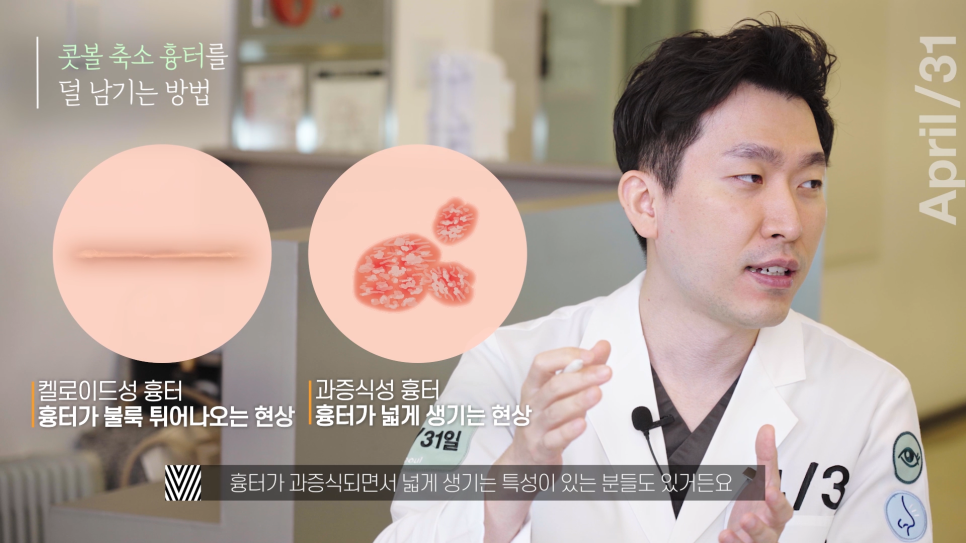 [Nose Surgery] Is It Possible to Reduce a Bulbous Nose with Alar Reduction? Yes or No? image 8