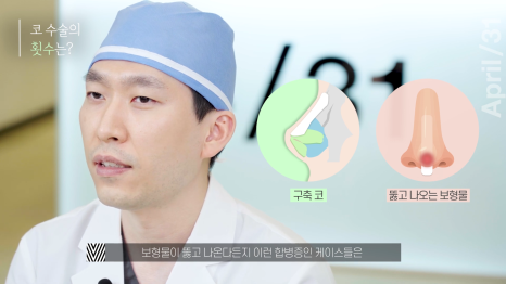[코성형] 어디에서도 알려주지 않는 코성형에 대한 모든것 - 코수술 QnA Time! 관련 이미지 5