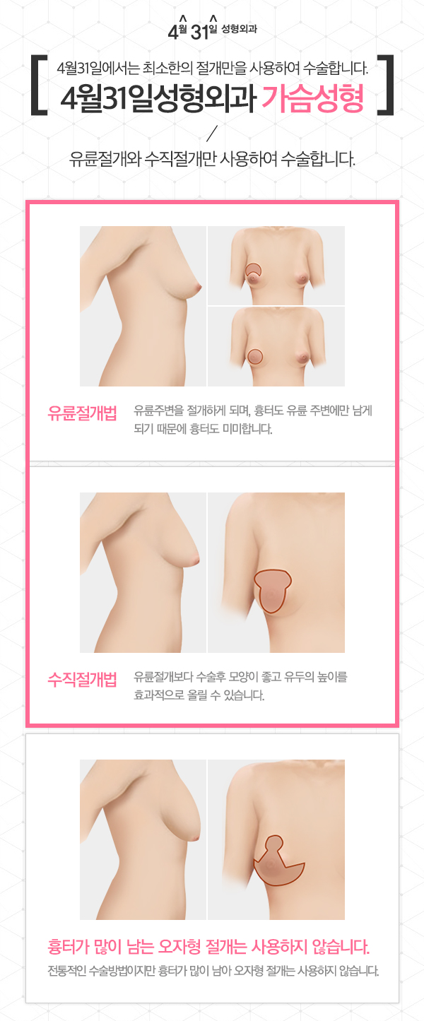 가슴업수술 처진가슴은 4월31일성형외과에서 관련 이미지 2