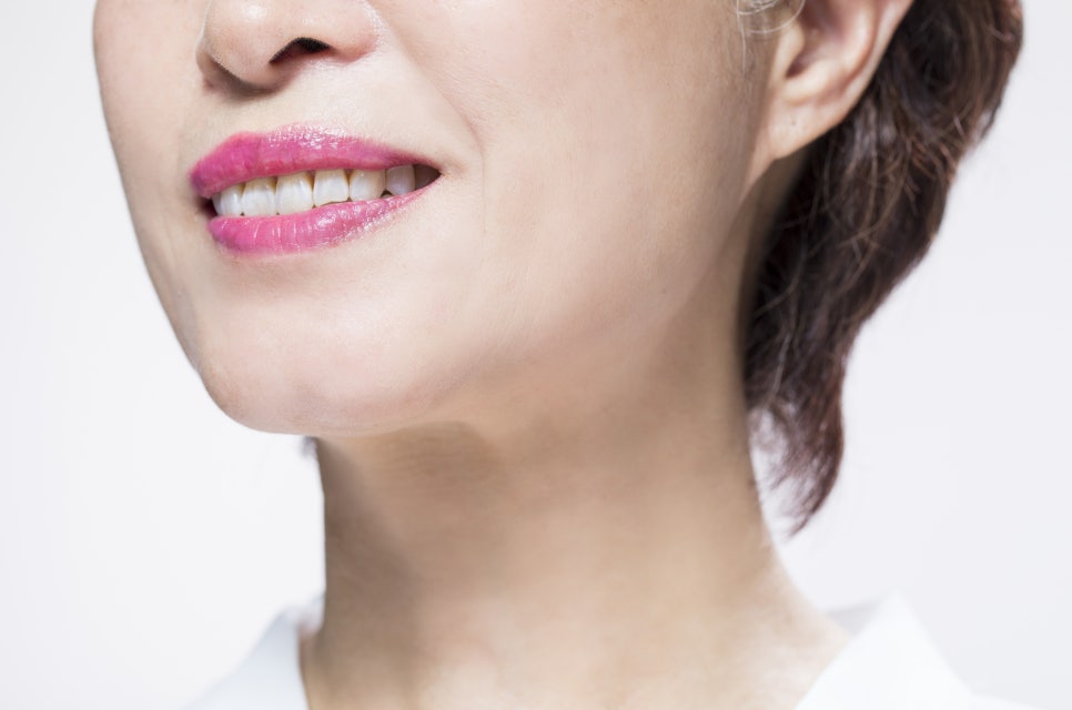 The Effects of Thread Lifting That Make You Look 10 Years Younger and Who It’s Recommended For, a Procedure Many Celebrities Also Do image 4
