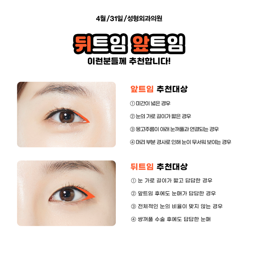 앞트임잘하는곳 만족스러운 결과를위해 관련 이미지 6