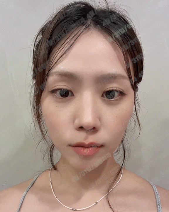 [4/31] 4월31일성형외과/Real-Re. Real Model. image 2