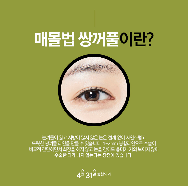 강남매몰잘하는곳 4월31일성형외과 남다른 결과 관련 이미지 3