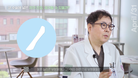 [코성형] 코에 넣은 자가진피, 마음에 안든다면? 관련 이미지 4