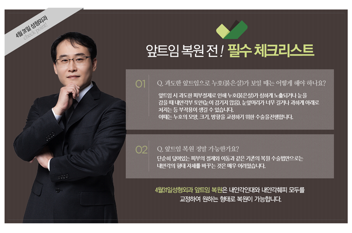 앞트임복원수술 4월31일성형외과라면 자연스럽게 관련 이미지 2