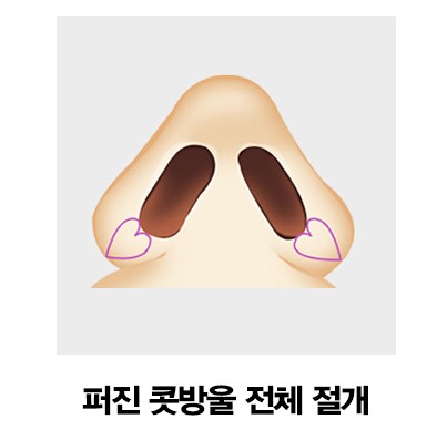 [코성형] 아름다운 코 모양의 완성은? 4/31 콧볼축소수술 관련 이미지 3