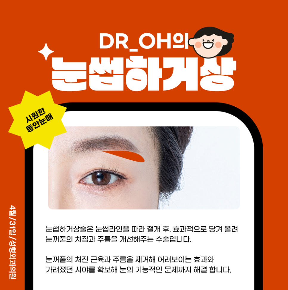 Eyelid Correction for Sagging Eyes with Dr. Oh Won-seok’s Brow Lift at April 31 image 1