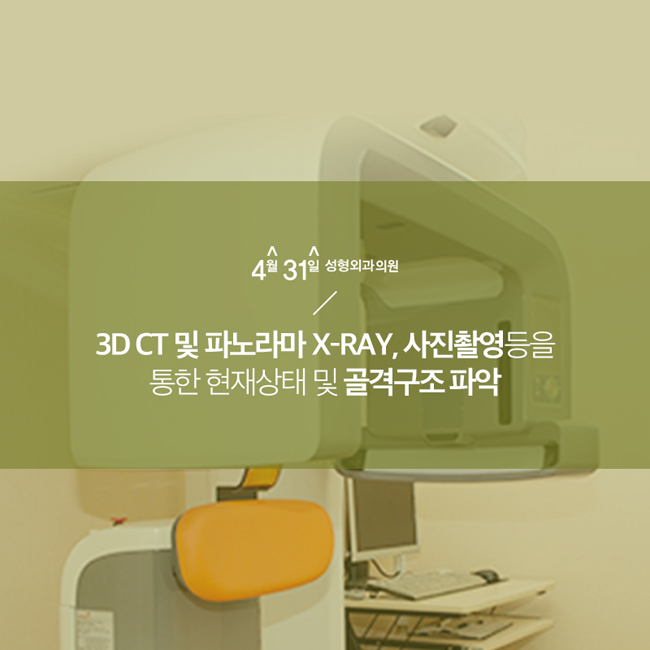 옆광대수술 4월31일성형외과 관련 이미지 3
