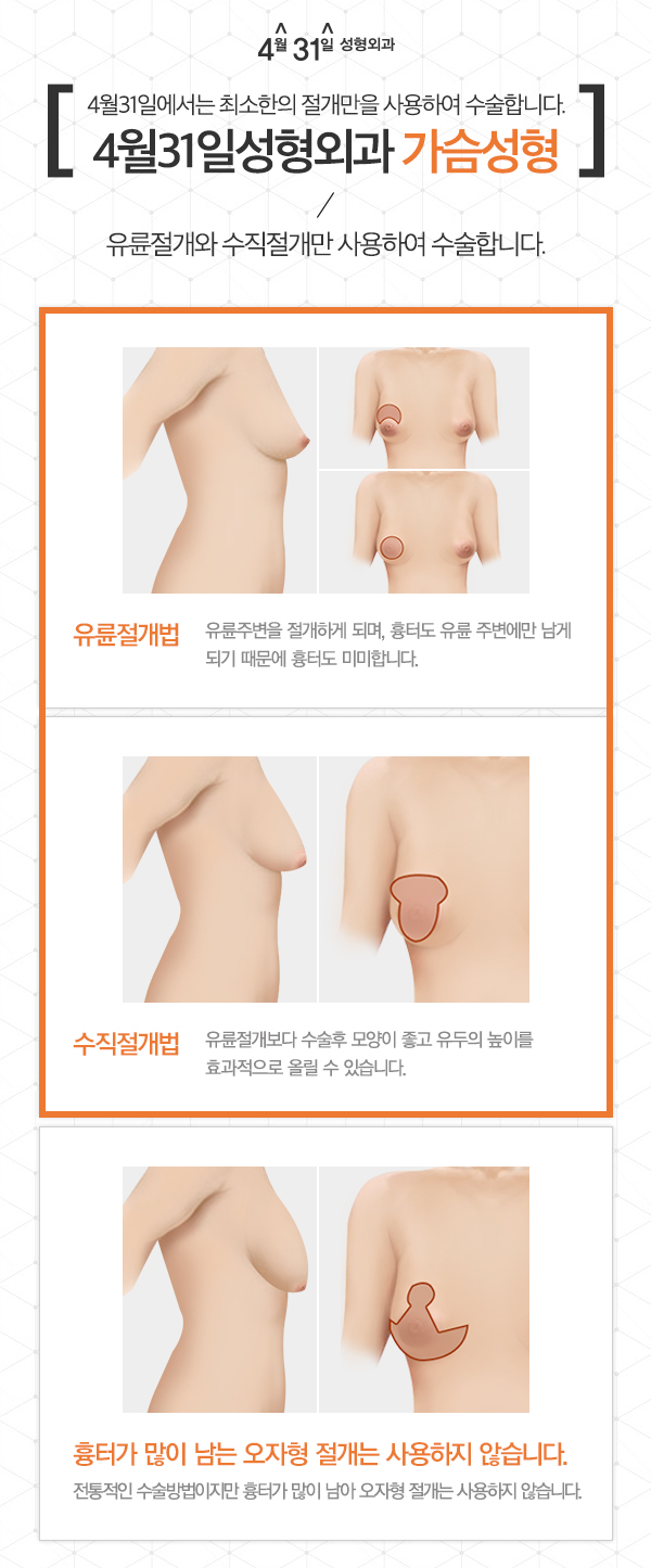 유방하수교정 4월31일성형외과의원 처진가슴수술 관련 이미지 3