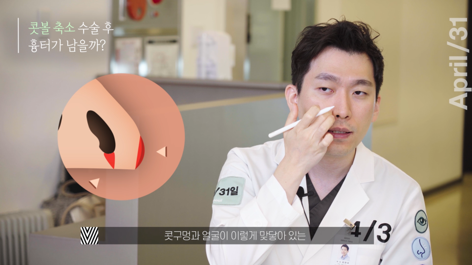 [Nose Surgery] Is It Possible to Reduce a Bulbous Nose with Alar Reduction? Yes or No? image 6
