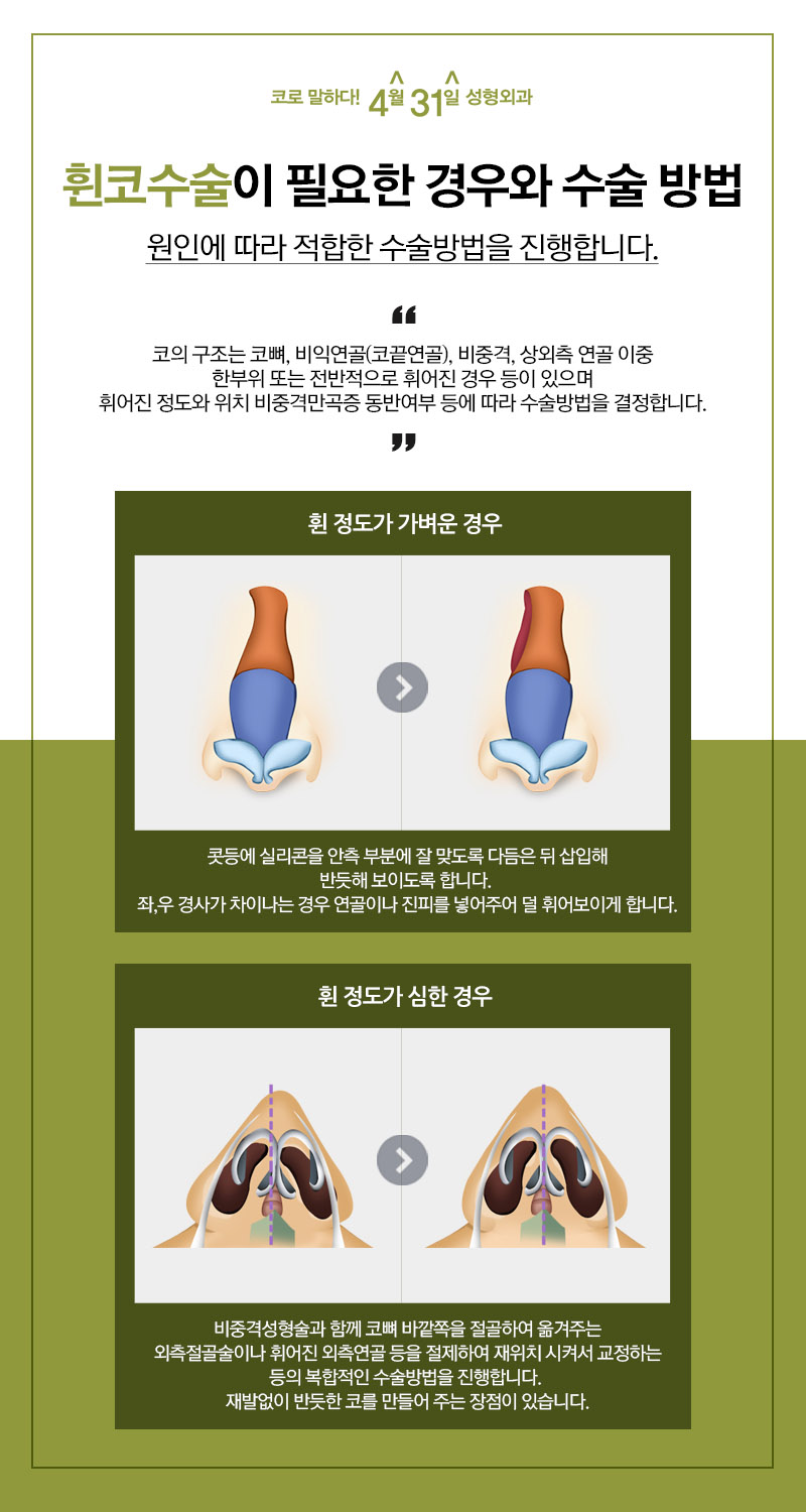 휜코수술효과 4월31일성형외과에서 확인! 관련 이미지 4