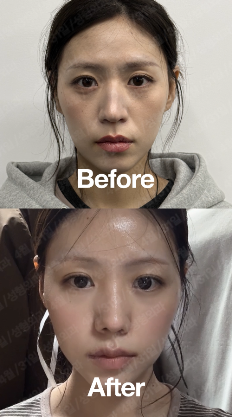[4/31] 4월31일성형외과/Real-Re. Real Model. image 13
