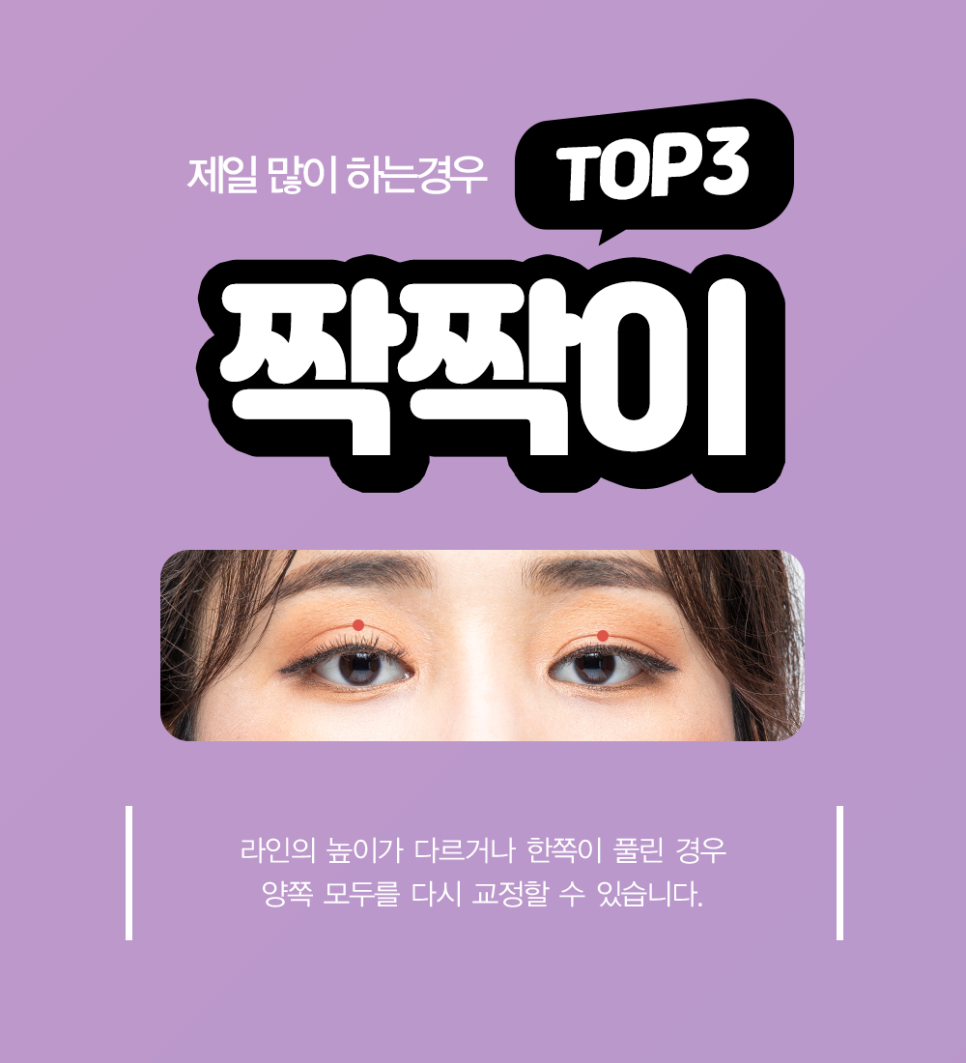 In What Cases Should You Consider Eye Revision Surgery at April 31 Plastic Surgery Clinic? image 4